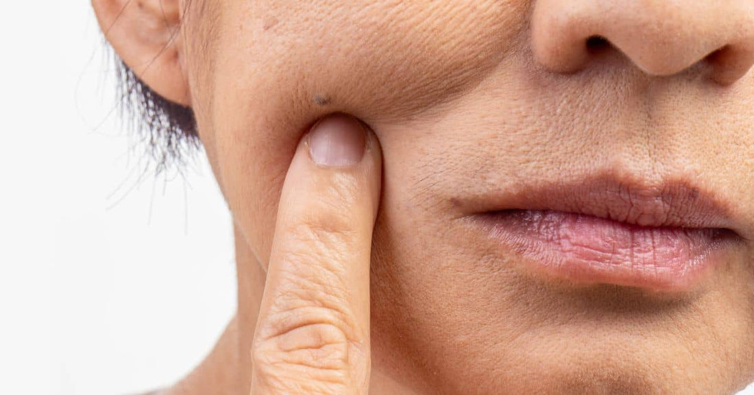 hard water aging skin