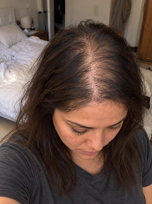 AI-generated illustration of hair before and after — before