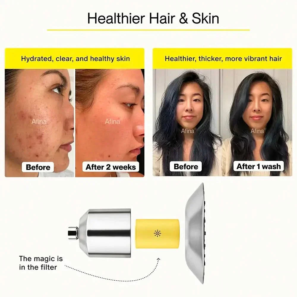 Afina Shower Filter: Banish Dandruff & Dry Scalp, Healthier Hair