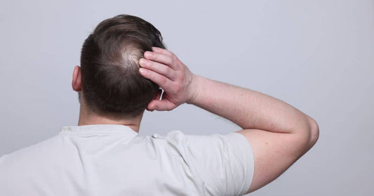 Filtered showerhead balding