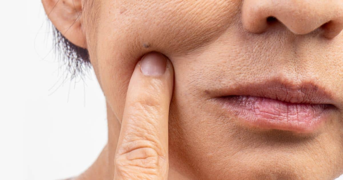hard water aging skin