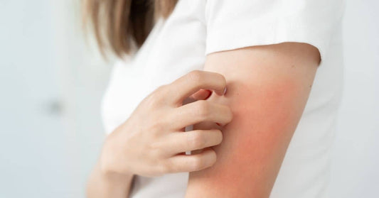 dry itchy skin after showering