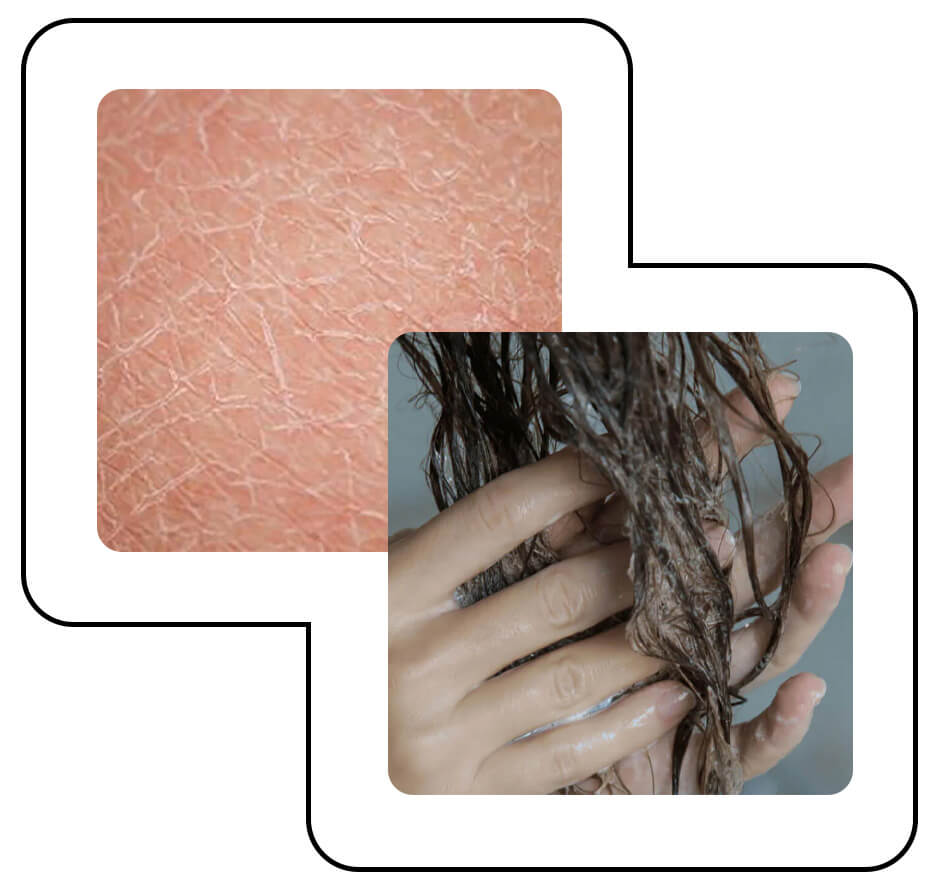 Hard water strips your hair and skin of natural oils.