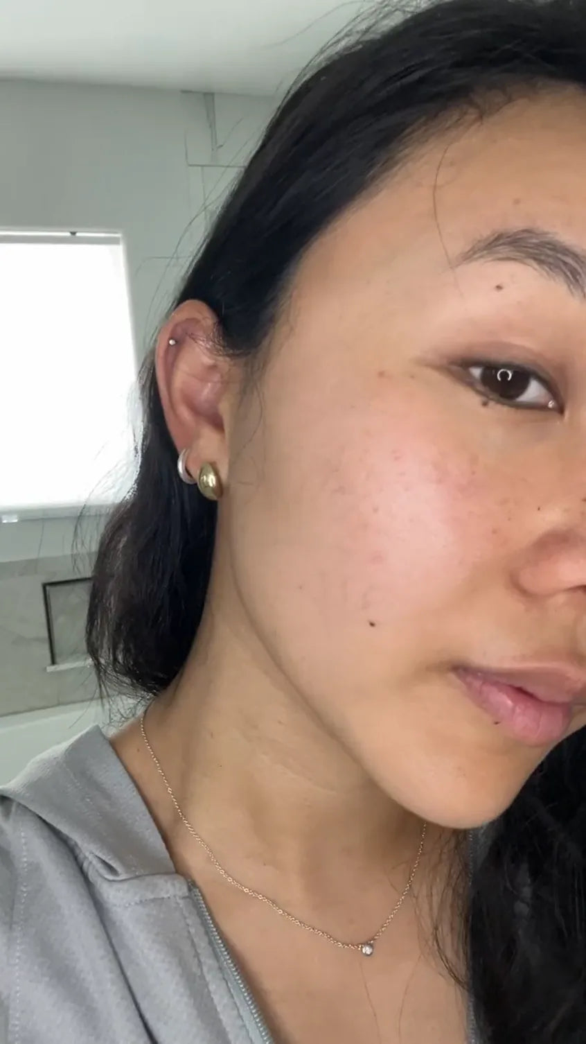 Customer video: skin transformation
