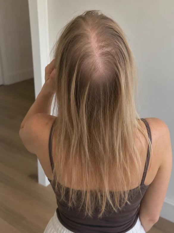 Hair before and after using Afina — before