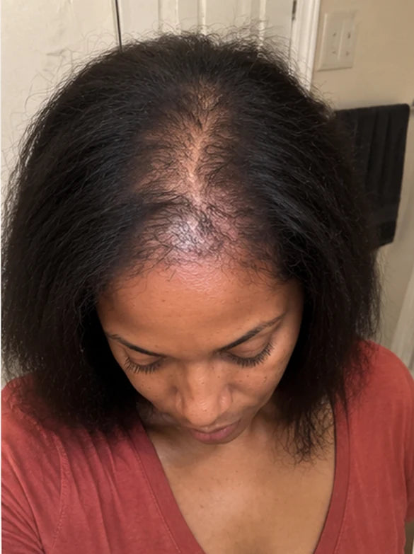 AI-generated illustration of hair before and after — before