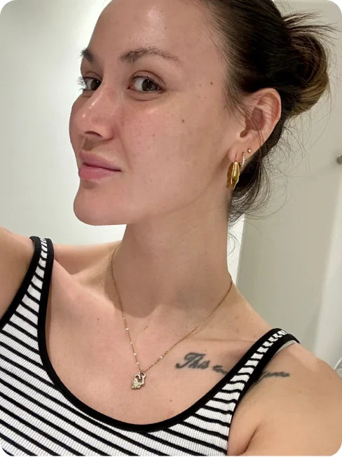 Skin before and after using Afina — after
