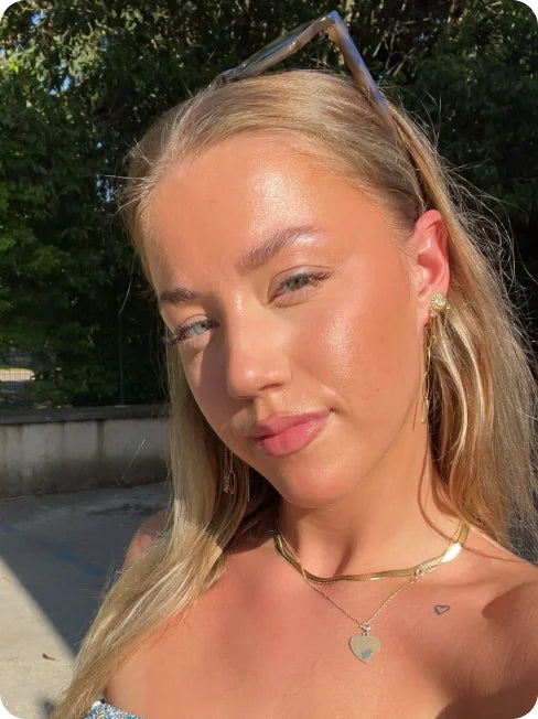 Skin before and after using Afina — after