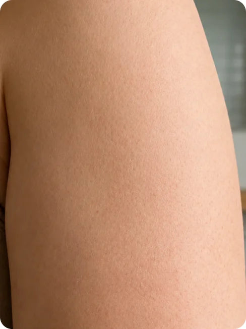 Skin before and after using Afina — after