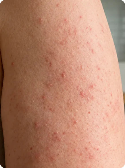 Skin before and after using Afina — before